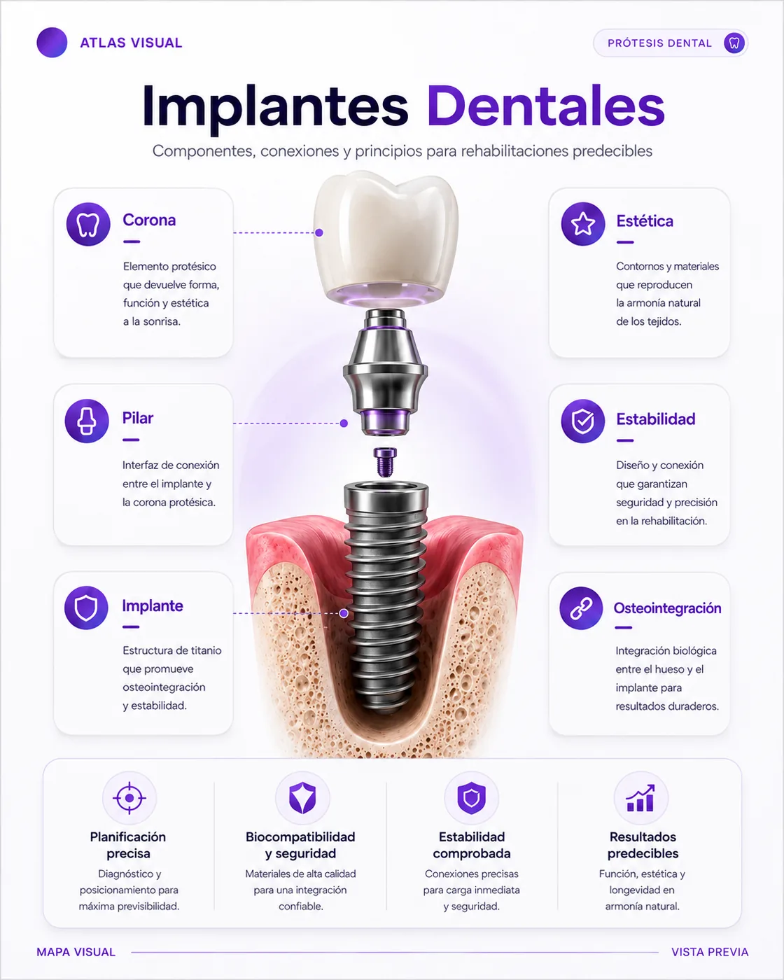 Ejemplo de mapa visual sobre implantes dentales